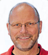 Zwei Z hne sind nah aneinander zu sehen, umgeben von Zahnfleisch und Haaren im Hintergrund. Beschreibung von KI generiert
